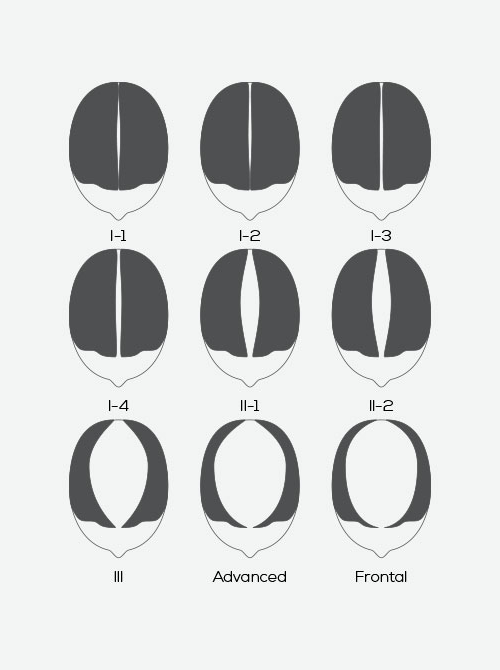 The Savin Scale