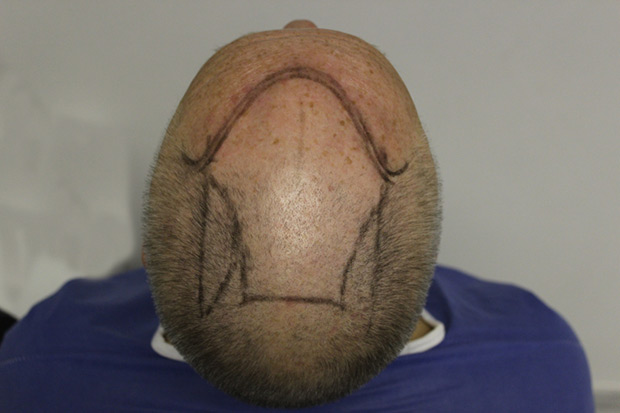 top-up-before2.jpg