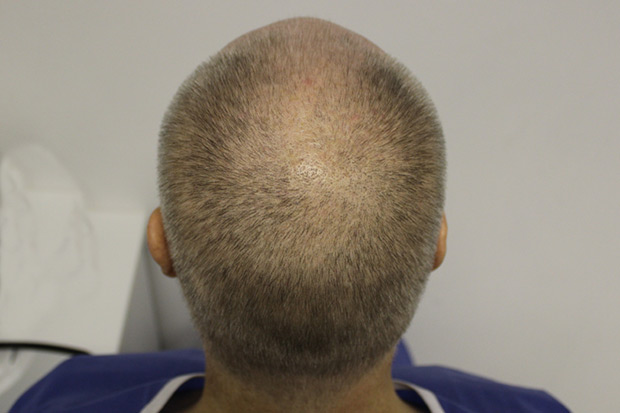 Crown-before1.jpg