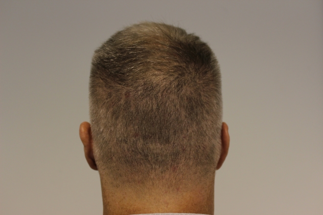 back-after.jpg