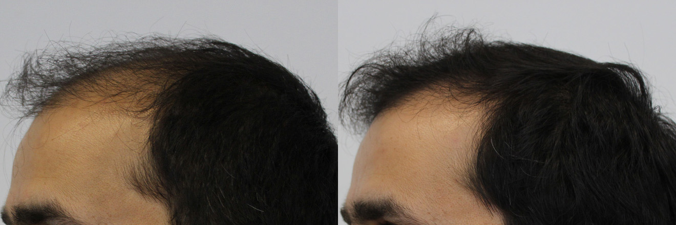 left-before-and-after.jpg