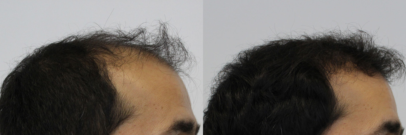 right-before-and-after.jpg