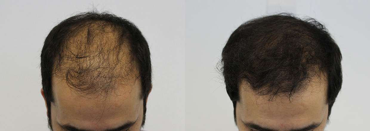 tilt-before-and-after.jpg