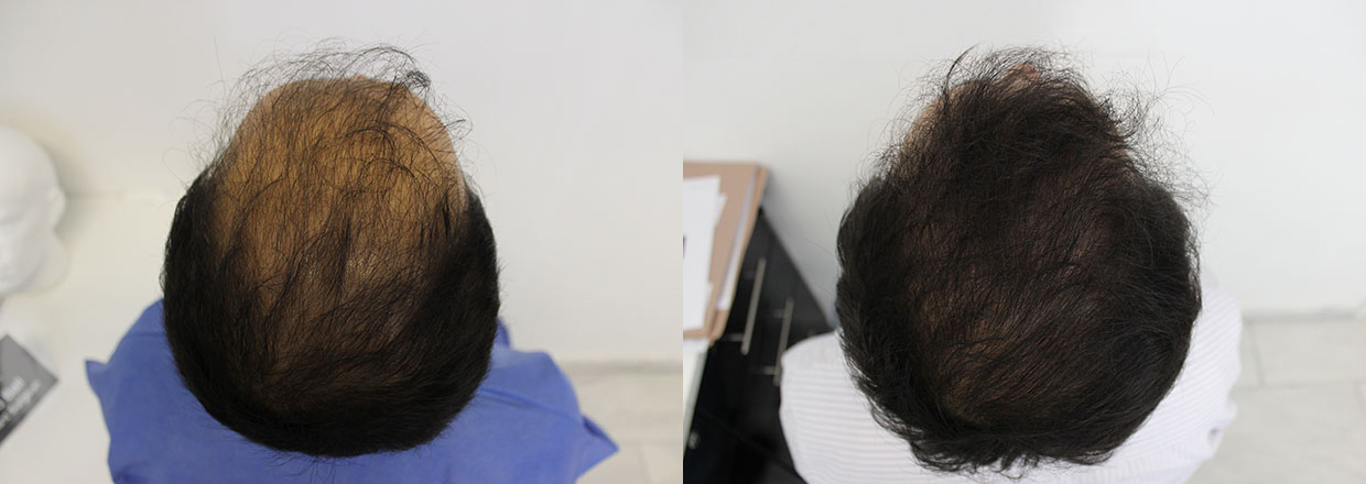 top-up-before-and-after.jpg