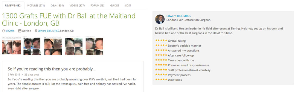 London Hair Transplant Clinic Review