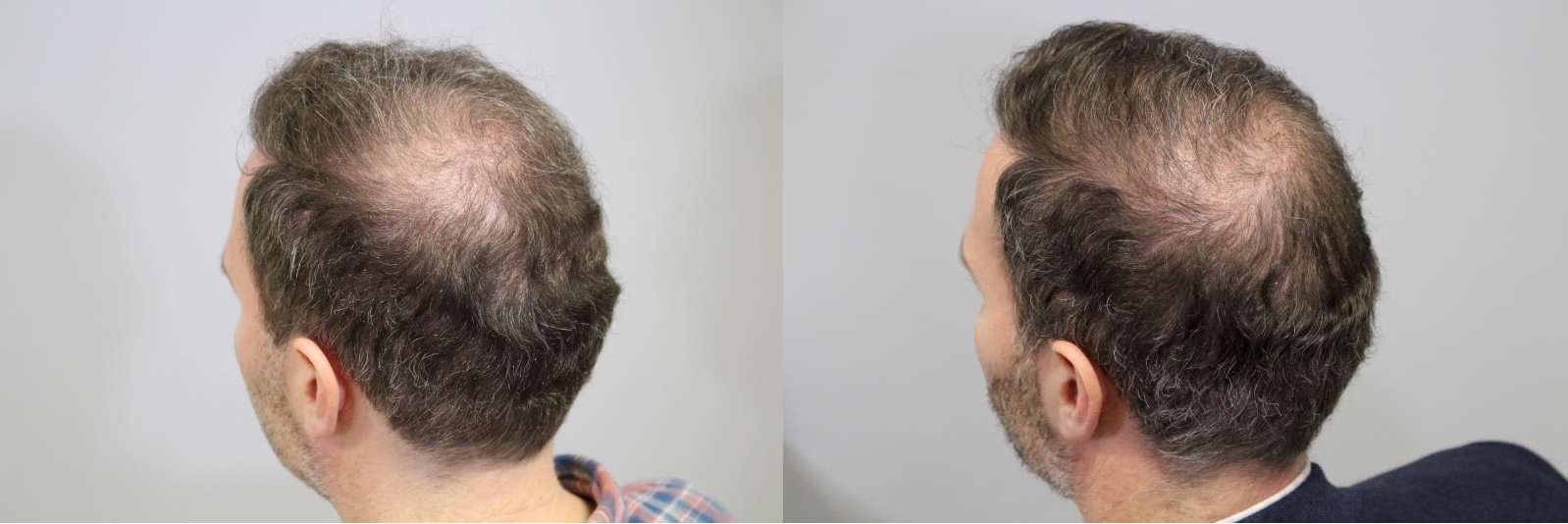 Compare-Crown.jpg