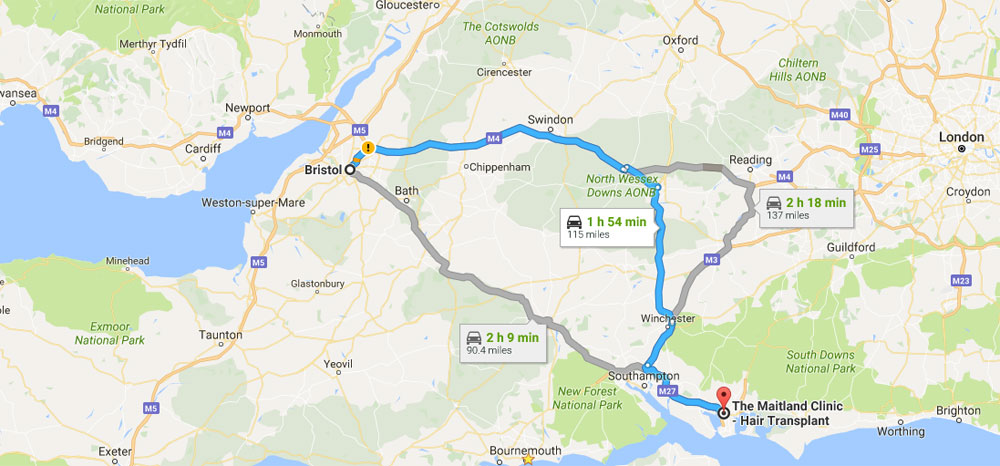 Hair Transplant Bristol - Map to get here