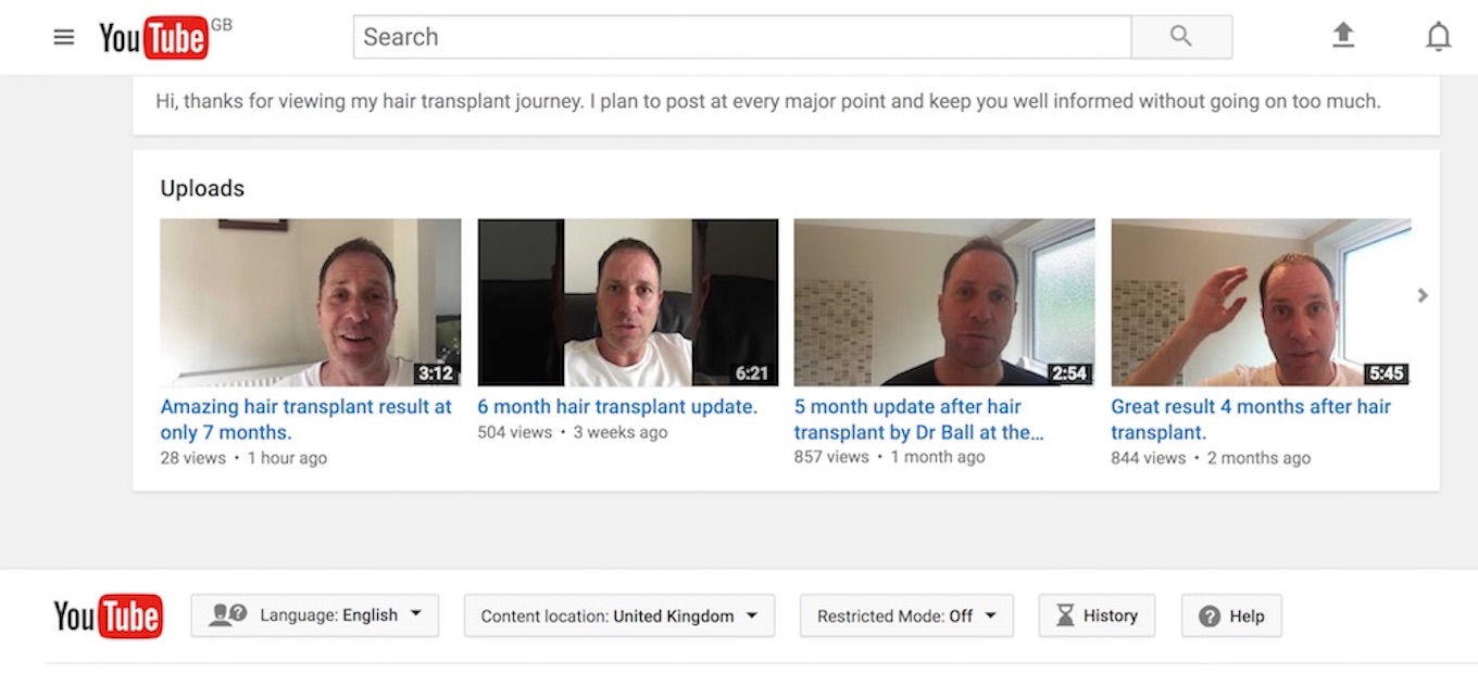 Follow Sig G’s video blog of his hair transplant journey