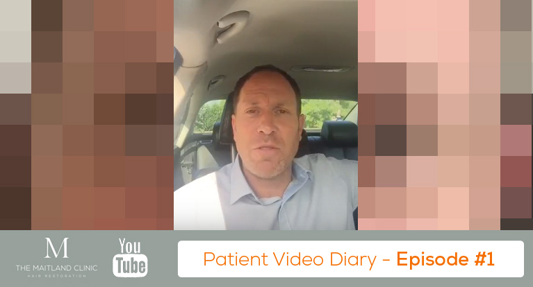 FUT Hair Transplant Day by Day – Subscribe to Watch Our Patient’s Video Diary #1