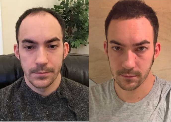 side-by-side.jpg