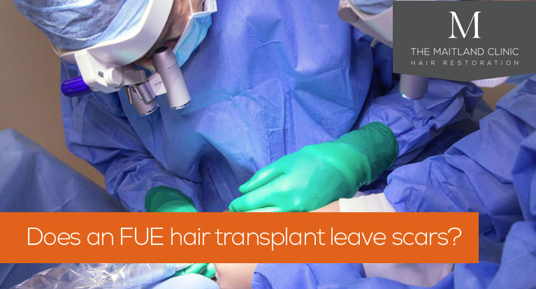 Does an FUE hair transplant leave scars?