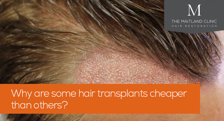 Why are some hair transplants cheaper than others?