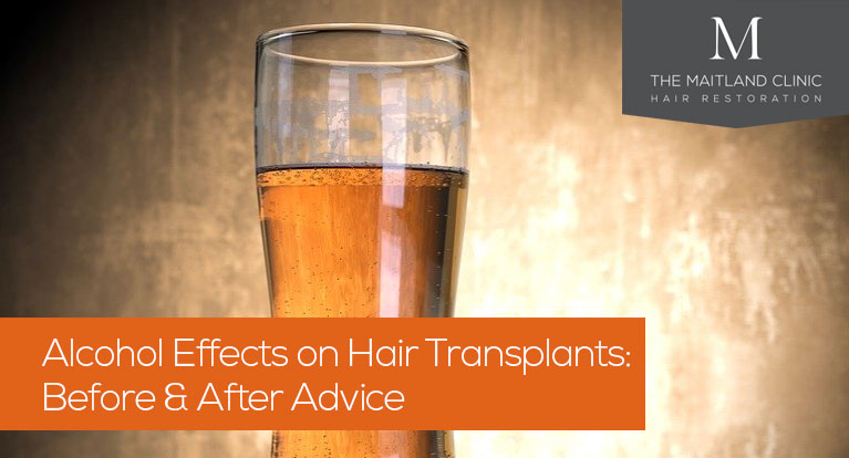 can i drink alcohol after a hair transplant