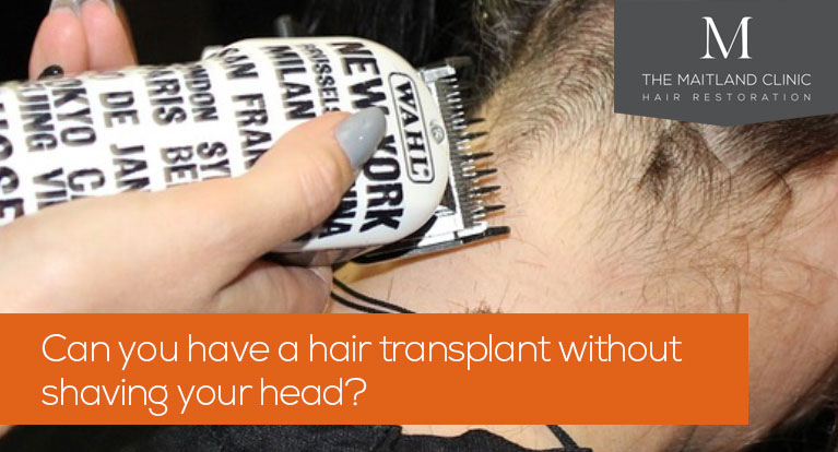 Can you have a hair transplant without shaving your head?