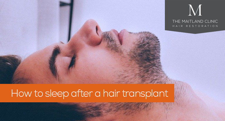 How to sleep after a hair transplant