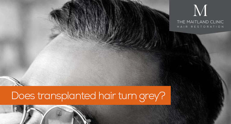 Does transplanted hair turn grey?