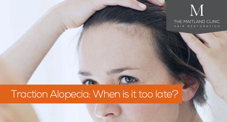 Traction Alopecia when is it too late