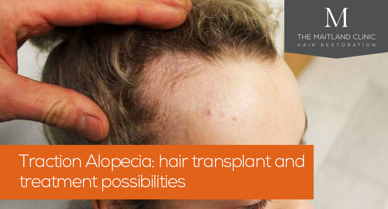 Traction Alopecia: hair transplant & treatment possibilities