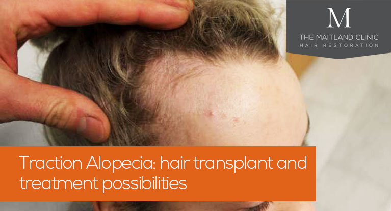 traction alopecia transplant